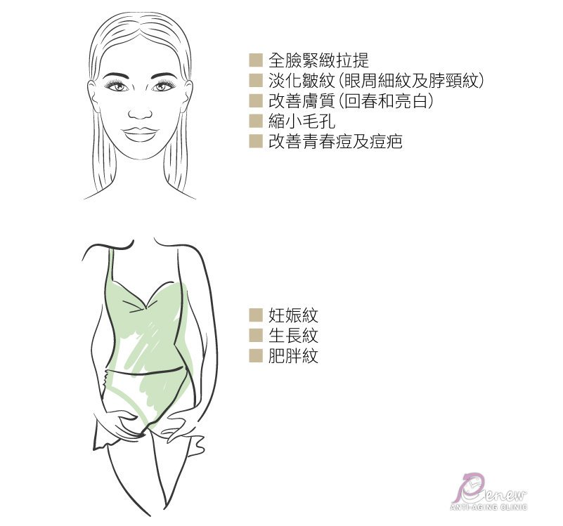【美魔黃金電波】一機搞定!皺紋、凹洞疤瑕疵膚質、松垂肌 通通OUT!,全臉緊緻拉提,淡化皺紋(眼周細紋及脖頸紋),改善膚質(回春和亮白),縮小毛孔,改善青春痘及痘疤,妊娠紋,生長紋,肥胖紋