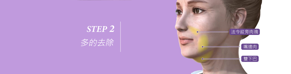 年輕化三原則第二步，下垂的先上提