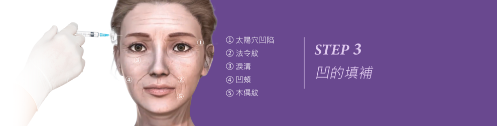 年輕化三原則第三步，凹的填補