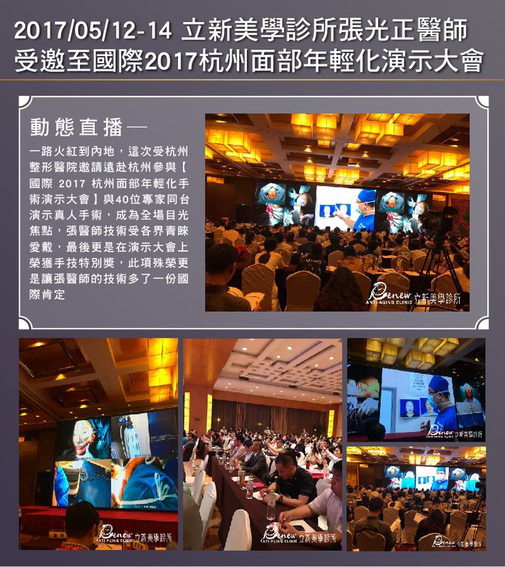 2017/05/12-05/14-國際2017 杭州面部年輕化演示大會