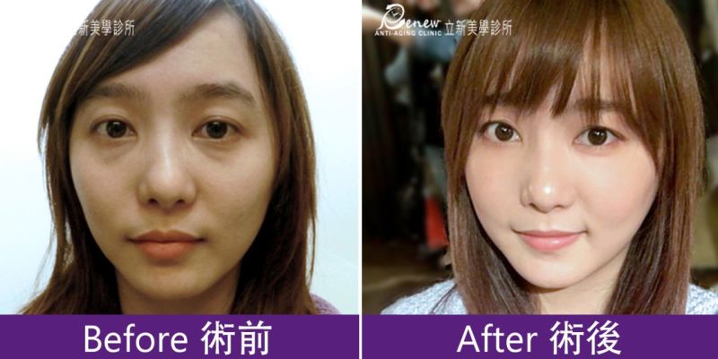 印地安紋、貓咪紋