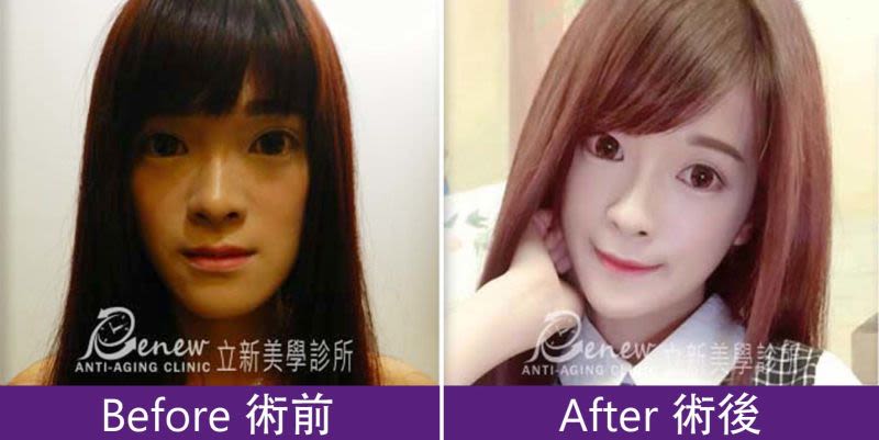 SVF