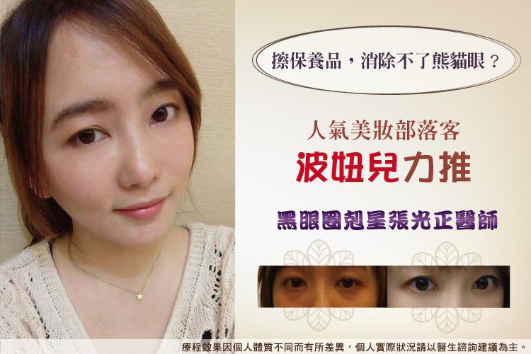 我的黑眼圈真的不見了!超人氣部落客【波妞兒】的見證!!