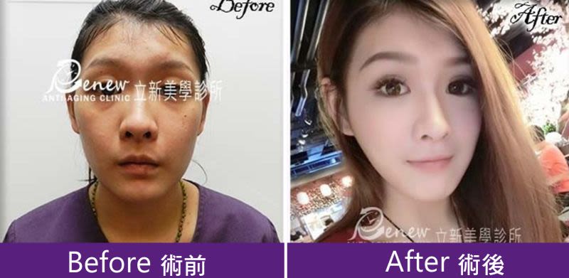 晶亮瓷