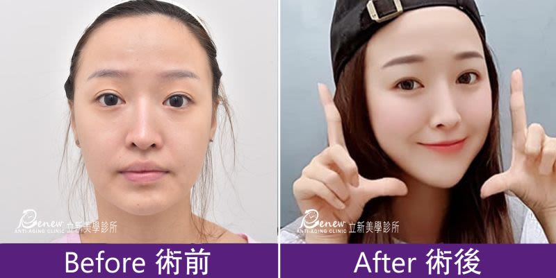 強升8字
