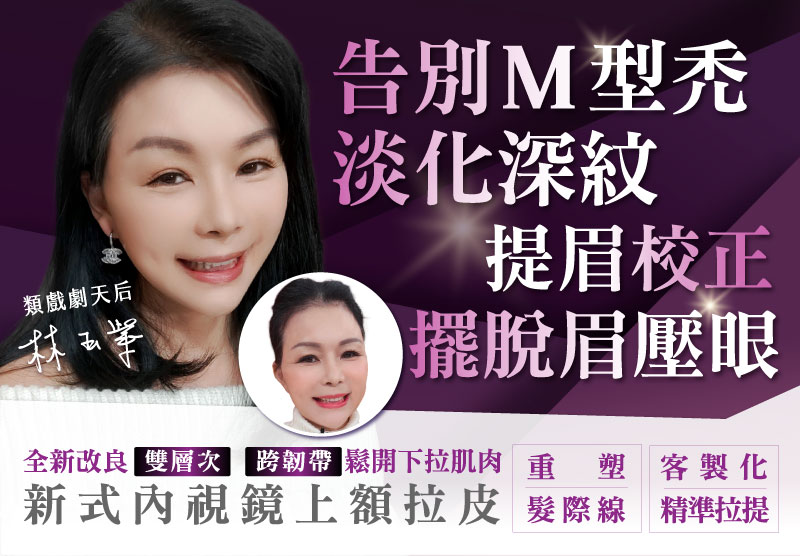 新式內視鏡上類戲劇天后拉皮4年後近況曝光 簡直像吃了防腐劑! 親揭「逆生長」機密 擺脫眼尾下垂、髮線高...她這樣做額拉皮