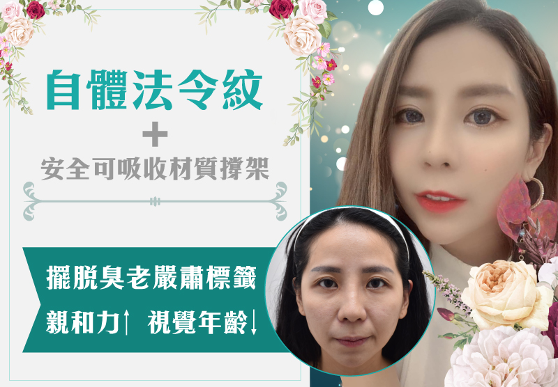 自體法令紋+安全可吸收材質撐架