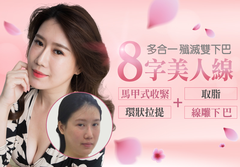 如何使下巴、脖子位置清楚不撈過界?美女蒂芬妮為浮腫側臉所苦,靠8字撐起門面,揮別雙下巴、嘴邊肉!