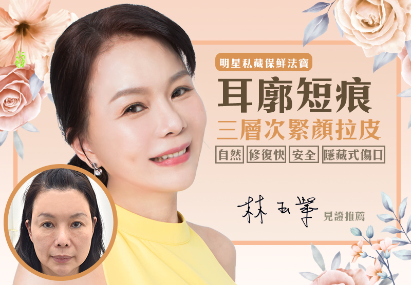 拉皮術前後差很大／類戲劇天后駕到！ 林玉紫人氣翻倍漲 找回年輕光彩就靠「這個」？