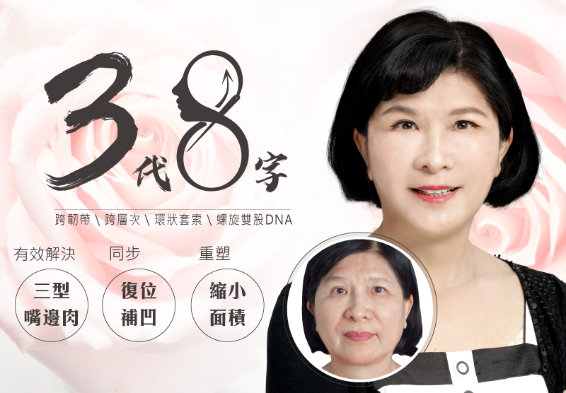 院長母親線雕拉提(線性拉提)實錄!擺平三八紋(淚溝、法令紋、木偶紋) 和醫師兒同框根本像姊弟!