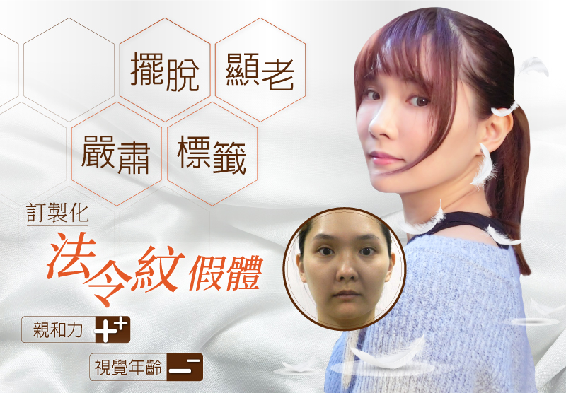 訂製化法令紋假體