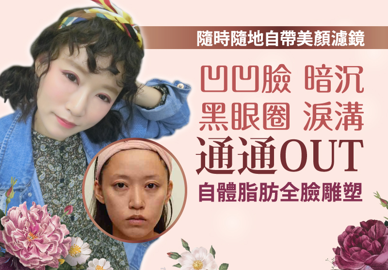 自體脂肪移植補臉