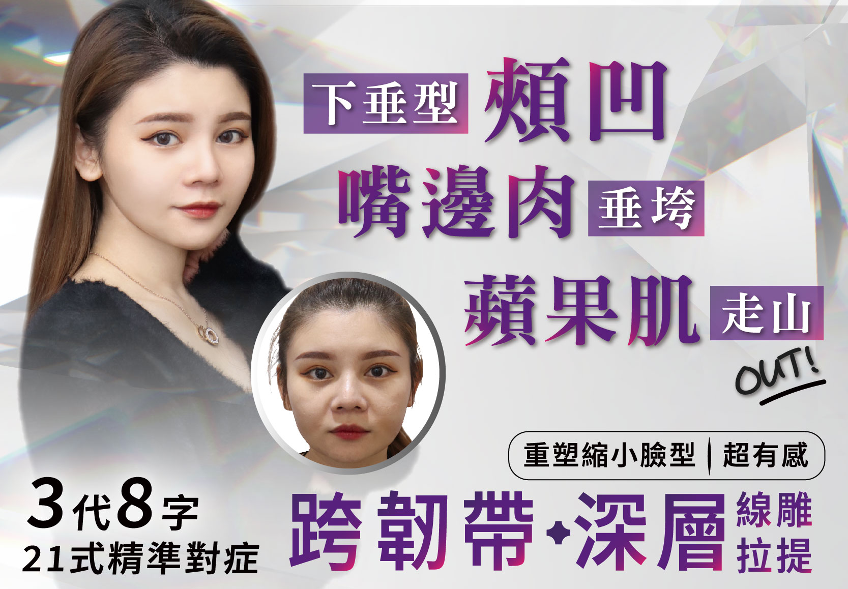 【3代8字-21式精準對症】下垂型頰凹 嘴邊肉垂垮 蘋果肌走山 out!