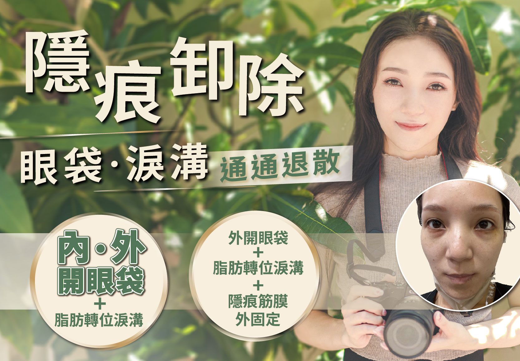 眼袋內開效果好嗎？ 「和眼袋外開差別」 真美學正妹員工親自見證 不瞞全說了！