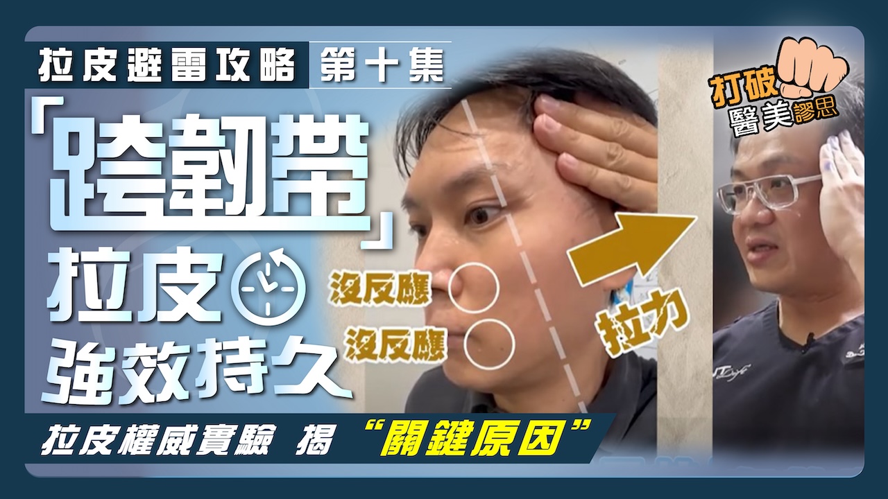 【拉皮避雷攻略|第十集】拉皮手術為何需要「跨韌帶」拉提「內側臉」? 筋膜拉皮效果維持太短暫嗎? 拉皮權威用實驗告訴你「關鍵原因」