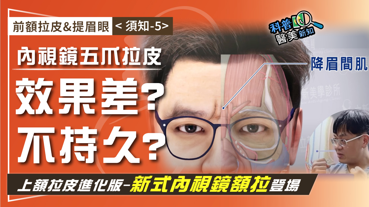 前額拉皮&提眉眼<須知-5>內視鏡上額拉皮再進化! 改良傳統五爪前額內視鏡拉皮缺點 抬頭紋/皺眉紋/眉眼下垂/M型禿 一次搞定!