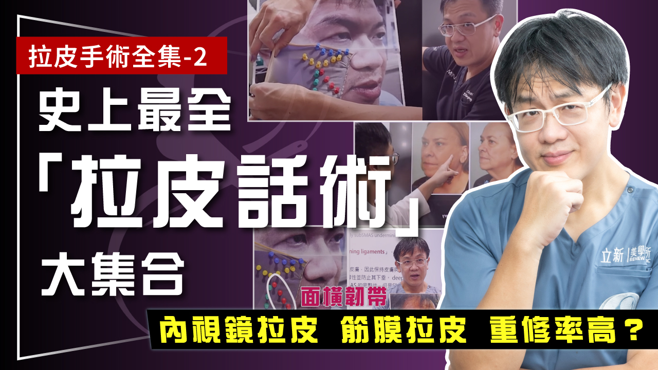 拉皮手術全集-2｜腦波弱的快來看！ 史上最全「拉皮話術」大集合 揭露內視鏡拉皮、筋膜拉皮超高重修率原因