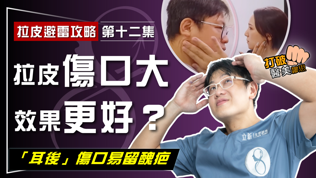 【拉皮避雷攻略｜第十二集】拉皮手術傷口大效果更好嗎？ 老派舊時「剪皮」手術該OUT了！ 醫學論文：「耳後」傷口易留醜疤