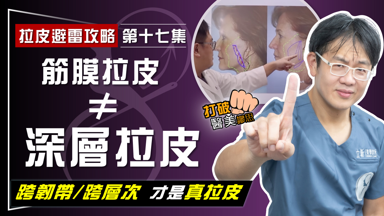 【拉皮避雷攻略|第十七集】筋膜拉皮手術非「深層拉皮」! 花大錢只做了「剪皮」手術? 權威支招:拉皮術中錄影才有保障