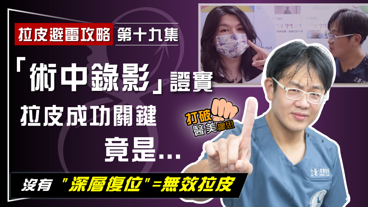 【拉皮避雷攻略｜第十九集】沒有深層復位=無效拉皮！ 拉皮手術錄影證實：「內側臉」深層復位拉皮 才是年輕化關鍵