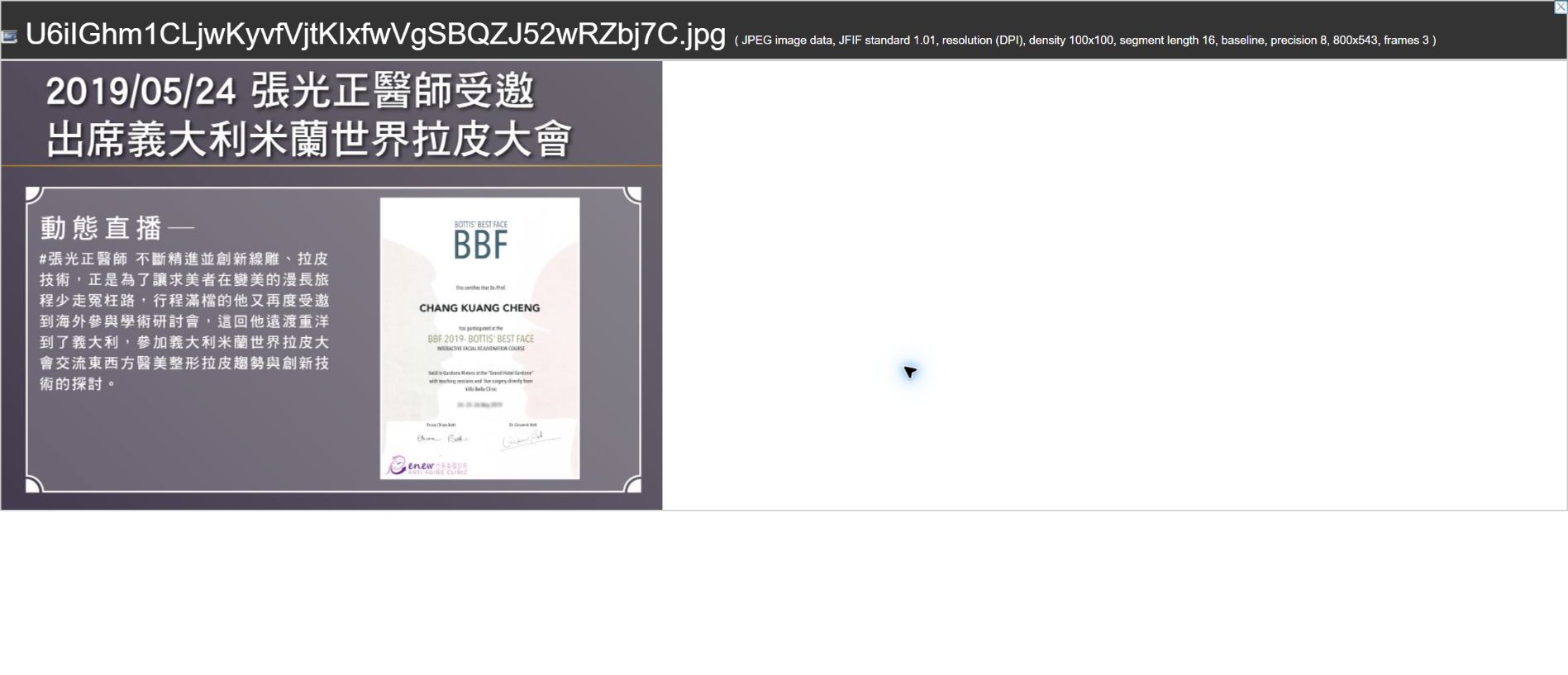 2019/05/24 張光正醫師受邀出席義大利米蘭世界拉皮大會