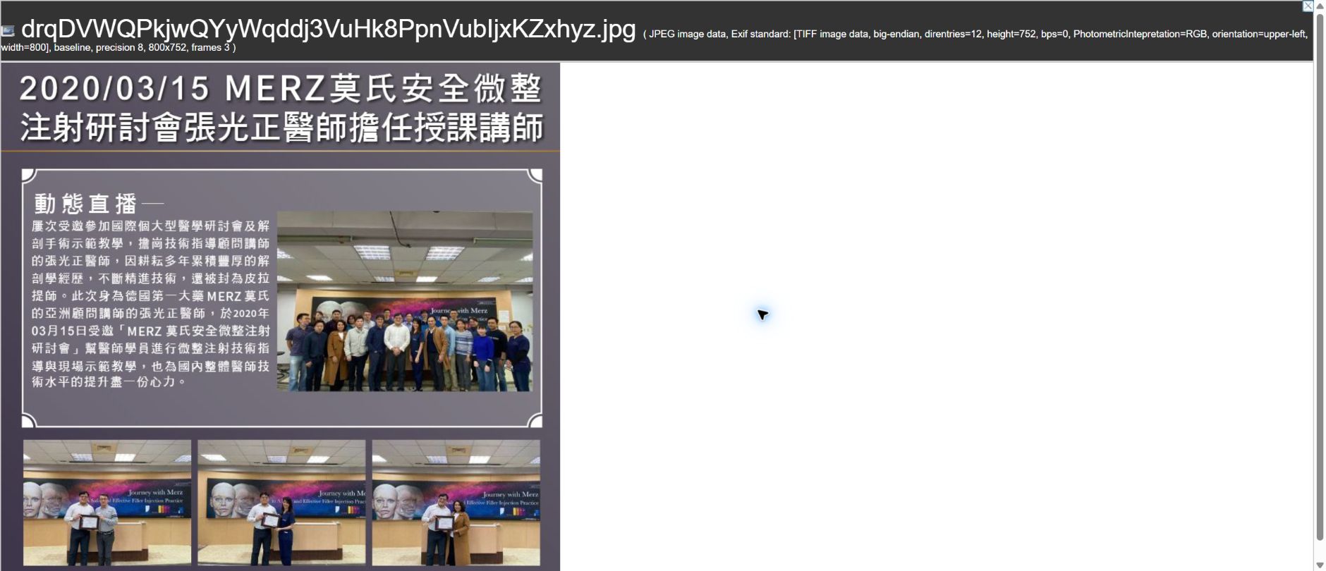 2020/03/15 MERZ莫氏 安全微整注射研討會－張光正醫師擔任授課講師