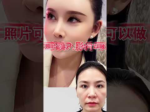 一般無痕筋膜拉提，效果不夠持久？擔心拉皮手術，恢復期太長？