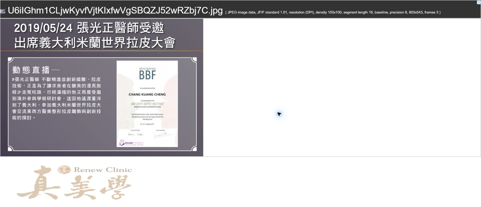 2019張光正醫師受邀出席義大利米蘭世界拉皮大會活動歷史影像