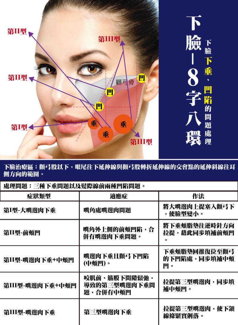二代8字-8字三環埋線拉提解決嘴邊肉下垂、臉頰凹陷問題