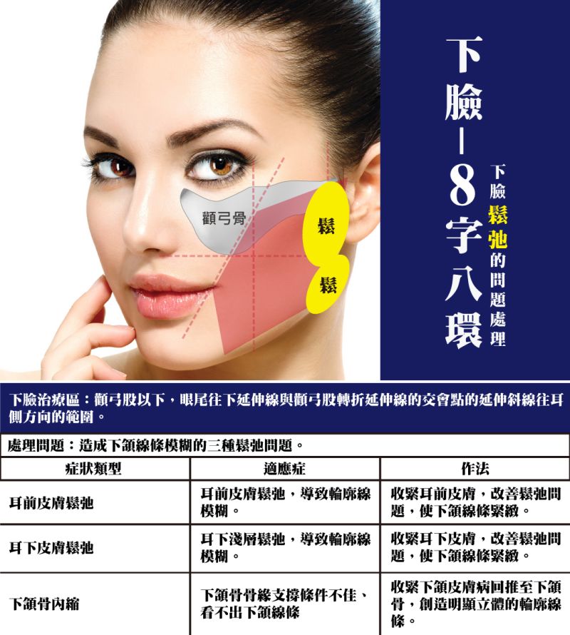 二代8字-8字三環埋線拉提解決臉部皮膚松弛、下頷線模糊問題？