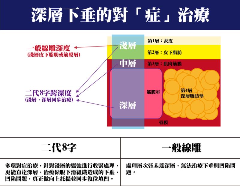 二代8字埋線拉提線雕多環對症治療，針對淺層松弛進行收緊處理，更能直達深層治療下垂凹陷等問題，做到真正向上托提並同步復位填凹