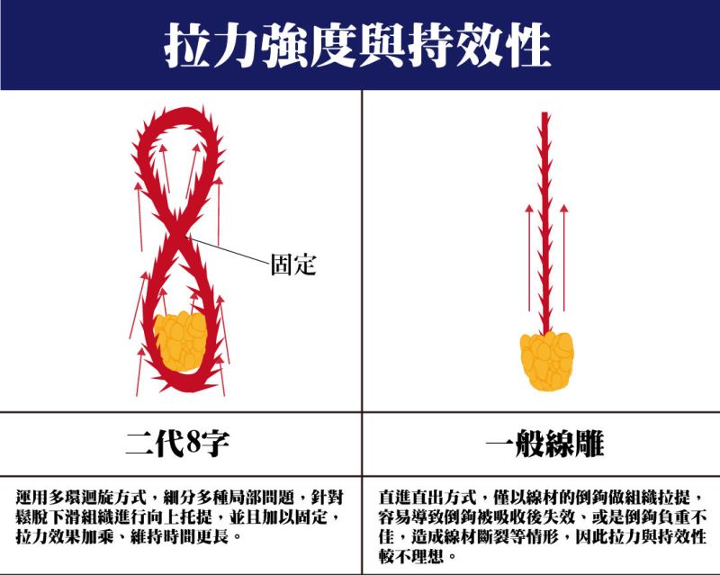 二代8字埋線拉提線雕，運用多環迴旋方式針對松脫下滑組織進行向上托提，比一般線雕拉力更強更持久